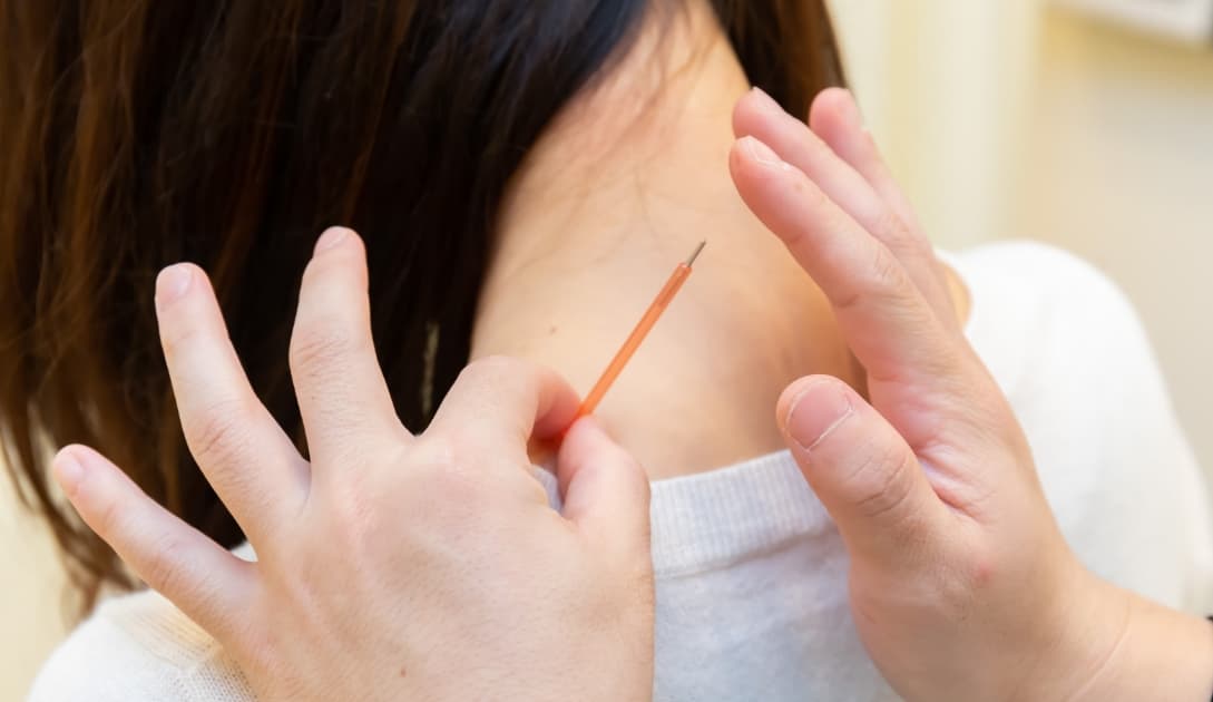 鍼灸